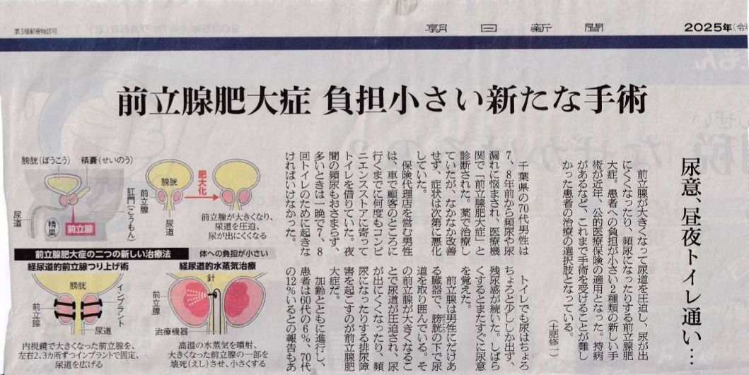 前立腺肥大症 負担小さい新たな手術